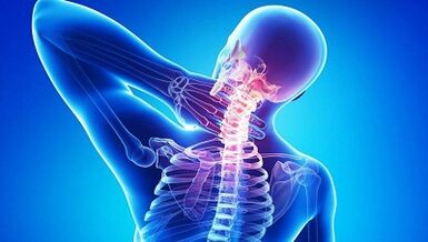 Hogyan nyilvánul meg az osteochondrosis