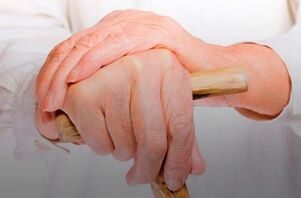 fájdalom az ujjak ízületeiben rheumatoid arthritisben