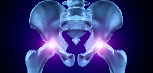 osteoarthritis a csípőízület